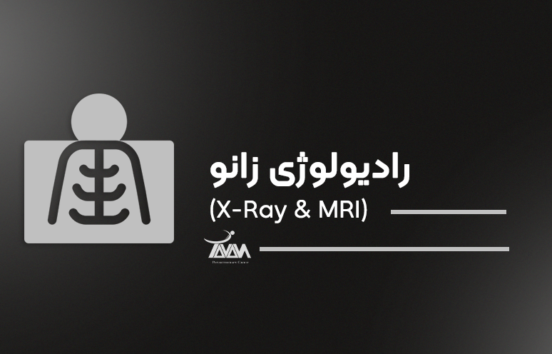 تصویر دوره رادیولوژی زانو (X-Ray & MRI)